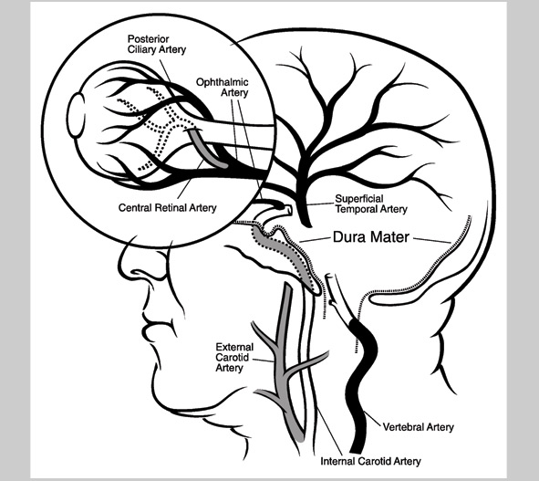 Duramater Illustration